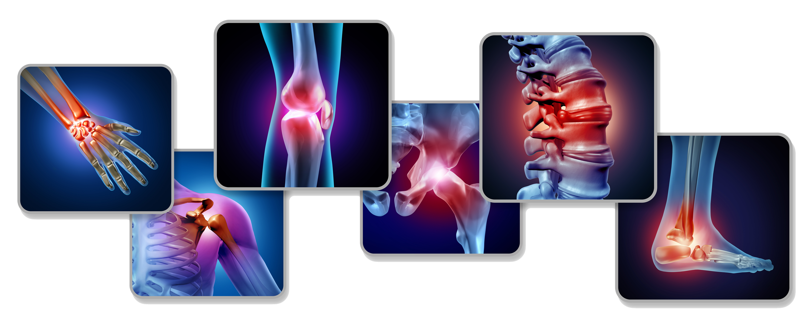 spine-joint-pain-about-us