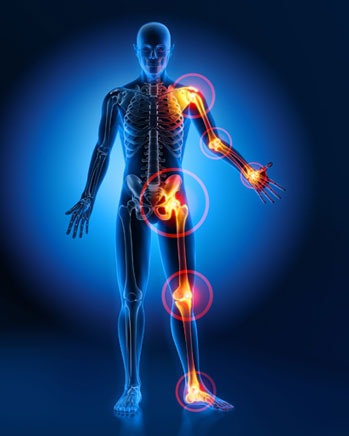 joint-pain