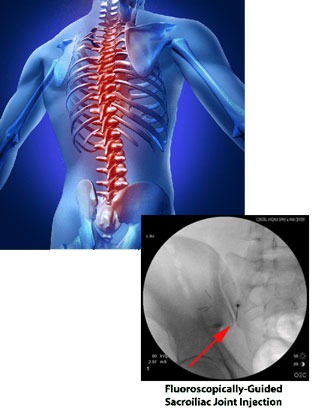 back-pain